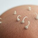 Odrastanie włosów po goleniu na łyso – co warto wiedzieć?